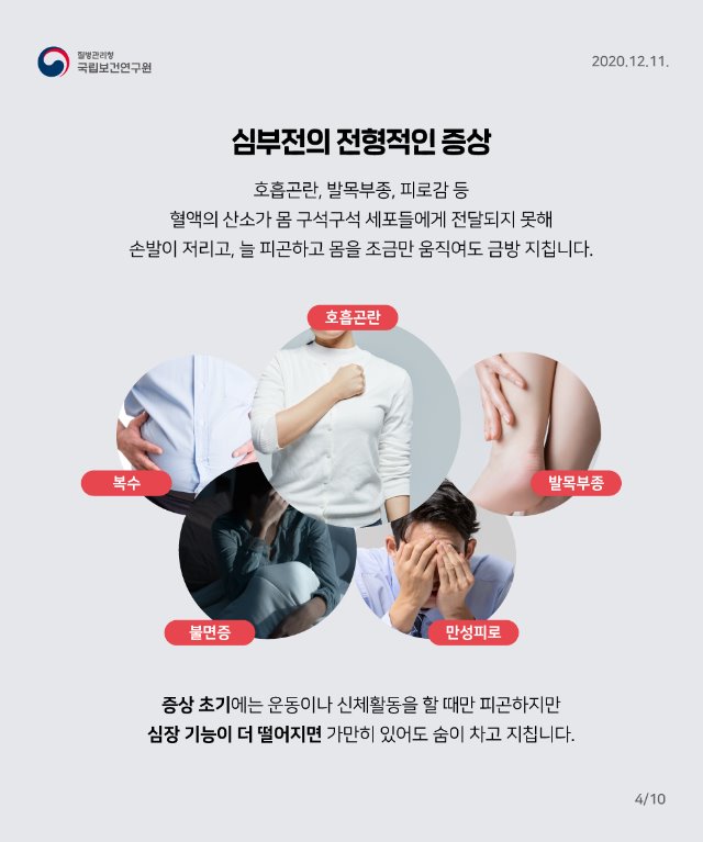 NIH_급성심부전_카드뉴스(4).jpg