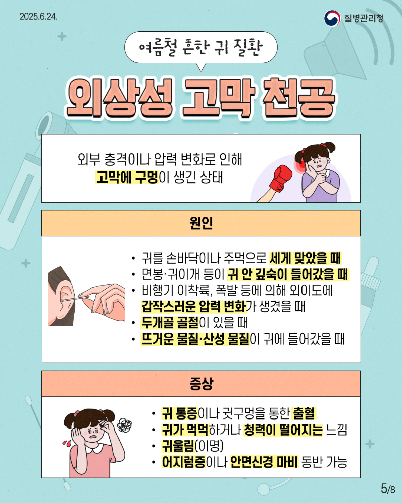 250624 여름철 귀 질환-5.png
