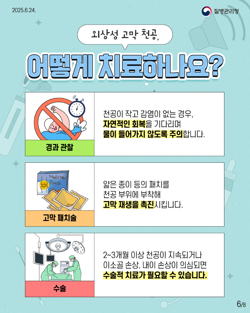 250624 여름철 귀 질환-6.png